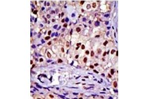 Image no. 1 for anti-RAD23 Homolog A (RAD23A) (C-Term) antibody (ABIN357606)