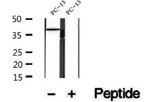 Western blot analysis of extracts of PC-13 cells, using URAT1 antibody. (SLC22A12 anticorps)