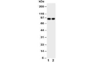 Western blot testing with Malt1 antibody; Lane 1: MCF-7;  2: HeLa cell lysate. (MALT1 anticorps  (C-Term))