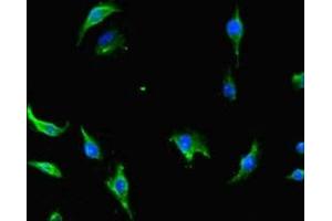 Immunofluorescent analysis of U251 cells using ABIN7147089 at dilution of 1:100 and Alexa Fluor 488-congugated AffiniPure Goat Anti-Rabbit IgG(H+L) (CNOT1 anticorps  (AA 604-867))