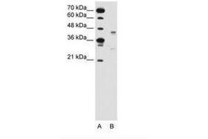 Image no. 2 for anti-G Protein-Coupled Receptor 161 (GPR161) (AA 201-250) antibody (ABIN6736635) (GPR161 anticorps  (AA 201-250))