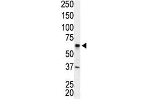 Western blot analysis of IRAK2 antibody and Jurkat cell lysate