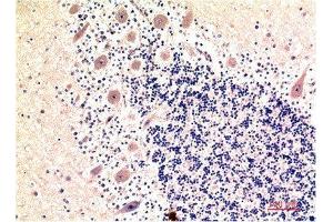 Immunohistochemical analysis of paraffin-embedded Human Brain Tissue using LC3B Mouse mAb diluted at 1:200. (LC3B anticorps)