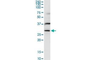 NAT6 MaxPab rabbit polyclonal antibody.