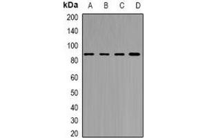 Western blot analysis of YT521-B expression in MCF7 (A), Jurkat (B), mouse brain (C), rat brain (D) whole cell lysates. (YTHDC1 anticorps)