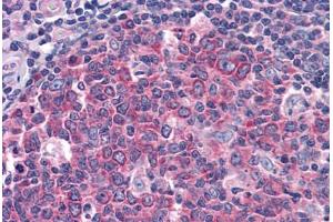 anti-Insulin-Degrading Enzyme (IDE) (AA 349-605) antibody