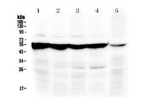 Western blot analysis of PAH using anti-PAH antibody .