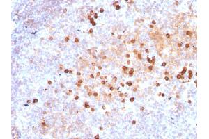 Formalin-fixed, paraffin-embedded human Tonsil stained with Purified IgM Mouse Monoclonal Antibody (IM373). (IGHM anticorps)