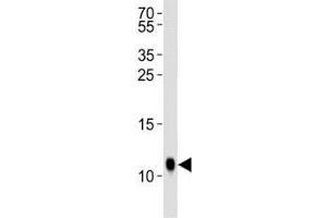 Western blot analysis of lysate from Drosophila tissue lysate using SUMO antibody diluted at 1:1000. (SUMO anticorps  (AA 37-66))