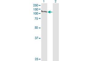 Western Blot analysis of MCM2 expression in transfected 293T cell line by MCM2 monoclonal antibody (M01), clone 6A8.