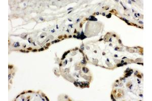 Anti- TIF1 gamma Picoband antibody, IHC(P) IHC(P): Human Placenta Tissue (TRIM33 anticorps  (AA 1001-1127))