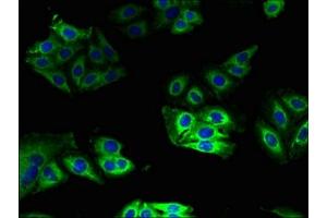 Immunofluorescent analysis of HepG2 cells using ABIN7149118 at dilution of 1:100 and Alexa Fluor 488-congugated AffiniPure Goat Anti-Rabbit IgG(H+L)