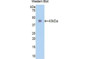 Western blot analysis of the recombinant protein. (CDK2 anticorps  (AA 93-211))