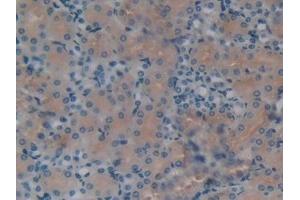 Detection of KLb in Mouse Kidney Tissue using Polyclonal Antibody to Klotho Beta (KLb)