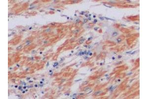 Detection of TIMP2 in Human Prostate Tissue using Polyclonal Antibody to Tissue Inhibitors Of Metalloproteinase 2 (TIMP2) (TIMP2 anticorps  (AA 27-220))