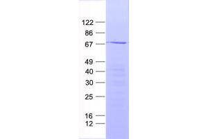 Validation with Western Blot