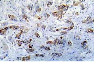 Immunohistochemistry (IHC) analyzes of CaMK2-a antibody in paraffin-embedded human A431 tissue. (CAMK2A anticorps)