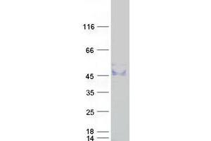 Validation with Western Blot