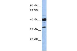 WB Suggested Anti-LRRC57 Antibody Titration: 0. (LRRC57 anticorps  (Middle Region))