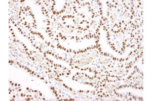Immunohistochemistry (IHC) image for anti-Nucleolin (NCL) (C-Term) antibody (ABIN7448702) (Nucleolin anticorps  (C-Term))