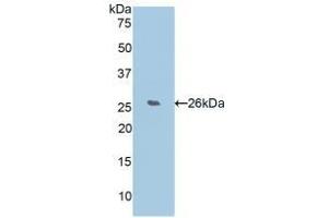 Detection of Recombinant WISP2, Human using Polyclonal Antibody to WNT1 Inducible Signaling Pathway Protein 2 (WISP2) (WISP2 anticorps  (AA 24-250))