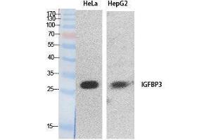 Western Blotting (WB) image for anti-Insulin-Like Growth Factor Binding Protein 3 (IGFBP3) (Internal Region) antibody (ABIN3178534) (IGFBP3 anticorps  (Internal Region))