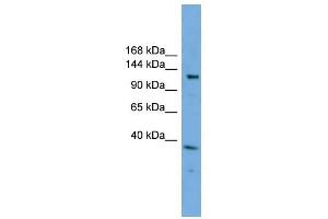 EIF4ENIF1 antibody used at 1 ug/ml to detect target protein. (EIF4ENIF1 anticorps  (N-Term))