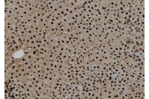 ABIN6273271 at 1/100 staining Rat liver tissue by IHC-P. (NAT10 anticorps  (Internal Region))