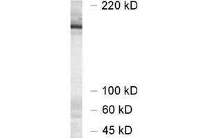 dilution 1 : 1000, sample: synaptic membrane fraction of rat brain (LP1) (UNC13A/Munc13-1 anticorps  (AA 3-317))