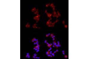Immunofluorescence analysis of SH-SY5Y cells using G Rabbit pAb (ABIN6131686, ABIN6140882, ABIN6140883 and ABIN6214785) at dilution of 1:350 (40x lens). (GABBR1 anticorps  (AA 200-460))