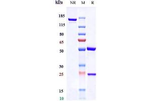 Anti-CTLA-4 / CD152 Reference Antibody (tremelimumab) on SDS-PAGE under reducing (R) condition. (Recombinant CTLA-4 (Tremelimumab Biosimilar) anticorps)