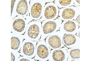 IHC analysis of BUB1B using anti-BUB1B antibody (ABIN7600962). (BUB1B anticorps  (AA 26-448))