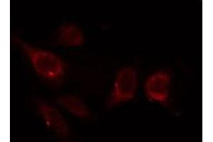 ABIN6267320 staining HepG2 by IF/ICC. (CDK1 anticorps  (pTyr15))
