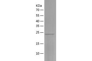 Western Blotting (WB) image for RAB3B, Member RAS Oncogene Family (RAB3B) (AA 1-219) protein (His-IF2DI Tag) (ABIN7124756)