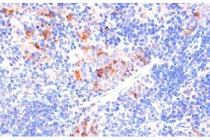 Immunohistochemistry of paraffin-embedded Mouse spleen using ARRB1 Polyclonal Antibody at dilution of 1:100 (40x lens). (beta Arrestin 1 anticorps)
