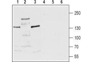 Western blot analysis of rat brain membrane (lanes 1 and 4), rat brain lysate (lanes 2 and 5) and mouse brain lysate (lanes 3 and 6): - 1-3. (TRPM3 anticorps  (1st Extracellular Loop))