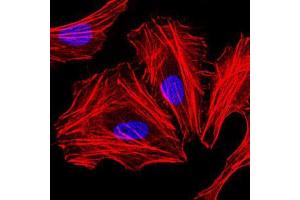 Immunofluorescence analysis of HeLa cells.