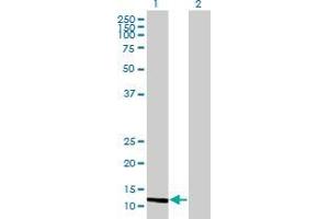 Western Blot analysis of MGP expression in transfected 293T cell line by MGP MaxPab polyclonal antibody.