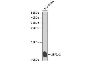 Western blot analysis of extracts of NCI-H460 cells using GTF2A2 Polyclonal Antibody at dilution of 1:1000. (GTF2A2 anticorps)
