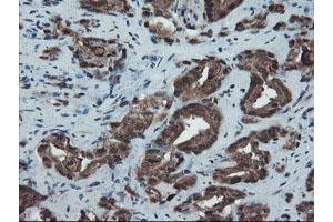 anti-SKI-Like Oncogene (SKIL) (AA 307-684) antibody