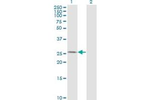 Western Blot analysis of AK3 expression in transfected 293T cell line by AK3 monoclonal antibody (M01), clone 1D2.