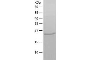 Western Blotting (WB) image for BCL2-Associated Athanogene 2 (BAG2) (AA 1-211) protein (His tag) (ABIN7121981) (BAG2 Protein (AA 1-211) (His tag))