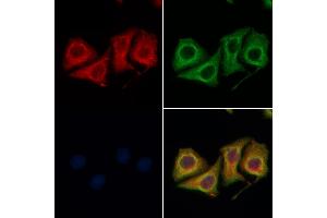 ABIN6258017 and ABIN6274334 staining Hela cells by IF/ICC.