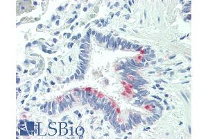 ABIN263186 (5µg/ml) staining of paraffin embedded Human Lung. (MTHFS anticorps  (Internal Region))