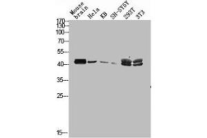 Western blot analysis of mouse-brain HELA KB SH-SY5Y 293T 3T3 lysis using MAGE-C2 antibody. (MAGEC2 anticorps  (Internal Region))