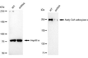 anti-Acetyl-CoA Carboxylase alpha (ACACA) antibody
