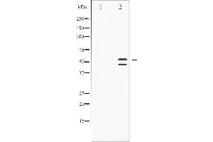 Western blot analysis of SAPK/JNK phosphorylation expression in Anisomycin treated HeLa whole cell lysates,The lane on the left is treated with the antigen-specific peptide. (SAPK, JNK (pThr183) anticorps)