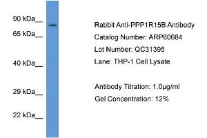 Western Blotting (WB) image for anti-Protein Phosphatase 1, Regulatory Subunit 15B (PPP1R15B) (C-Term) antibody (ABIN2774292) (PPP1R15B anticorps  (C-Term))
