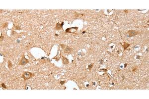Immunohistochemistry of paraffin-embedded Human brain using CAPG Polyclonal Antibody at dilution of 1:40 (CAPG anticorps)