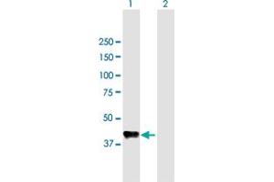 Western Blot analysis of CPB1 expression in transfected 293T cell line by CPB1 MaxPab polyclonal antibody. (CPB1 anticorps  (AA 1-417))